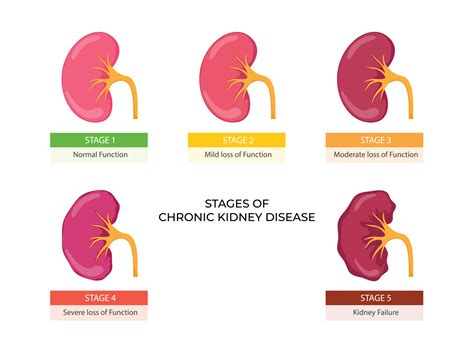 Chronic Kidney Disease Stage 5