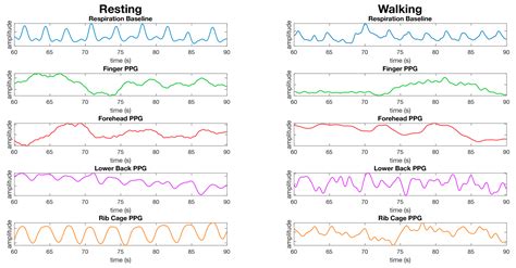 A Comparison of Reflective Photoplethysmography for Detection of Heart ...