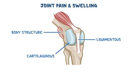 Causes Of Joint Pain And Swelling