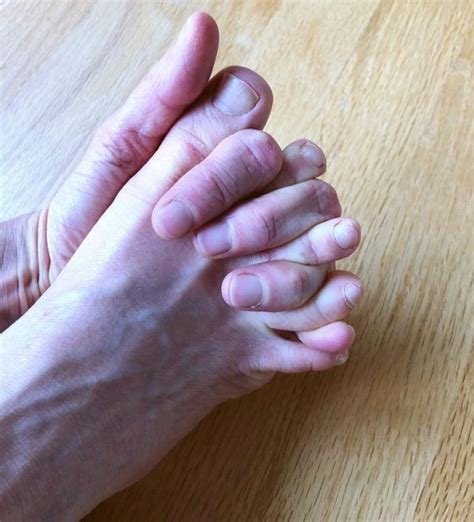 Ball of Foot Pain Running 的图像结果
