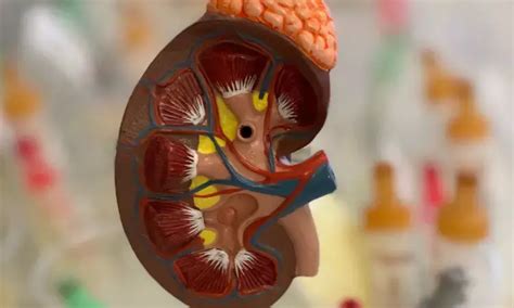 Mycophenolate mofetil-based regimen as effective as conventional ...