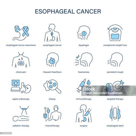 Esophageal Cancer Symptoms Diagnostic And Treatment Vector Icon Set Stock Illustration ...