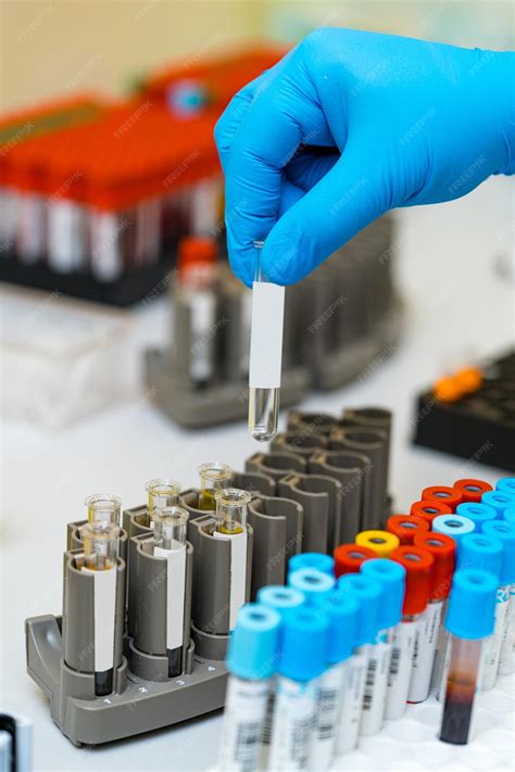 Image result for Blood Testing Laboratory