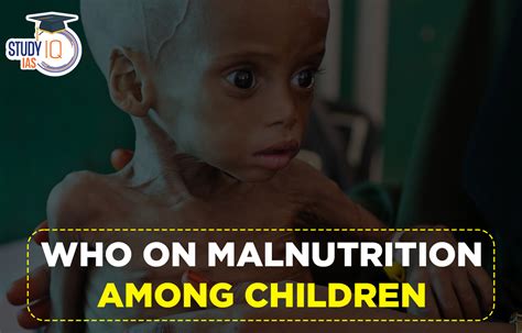 WHO on Malnutrition Among Children