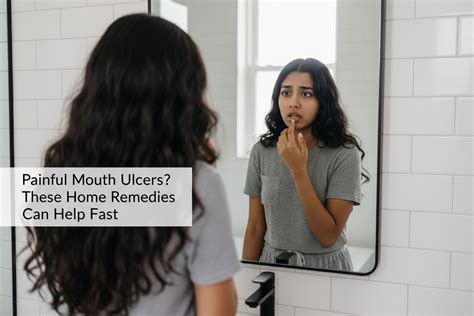 Painful Mouth Ulcers? These Home Remedies Can Help Fast – Ayushakti India