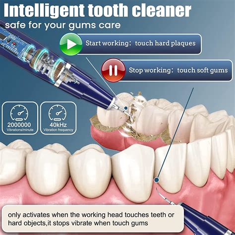 Teeth Plaque & Tartar Remover Kit with LED Light - 5 Modes for Dental Calculus Removal - Blue ...