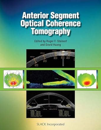 Buy Anterior Segment Optical Coherence Tomography Book Online at Low ...