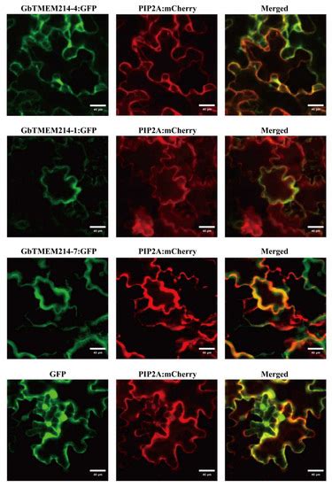 Membrane Localized GbTMEM214s Participate in Modulating Cotton ...