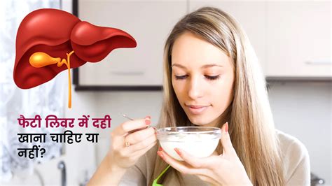 फैटी लिवर में दही खाना चाहिए या नहीं | Can We Eat Curd In Fatty Liver ...
