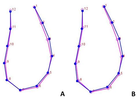 Geometric Morphometric Analysis of Mandibular Symphysis Growth between ...