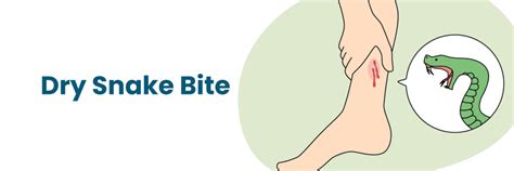 Mordeduras de serpiente secas: mitos, síntomas y guía de primeros auxilios