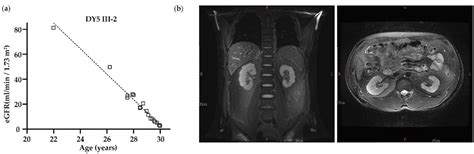 UMOD Mutations in Chronic Kidney Disease in Taiwan