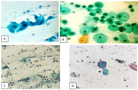 IJPO - Indian J Pathol Oncol