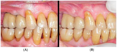 Analogical and Digital Workflow in the Design and Preparation of the ...