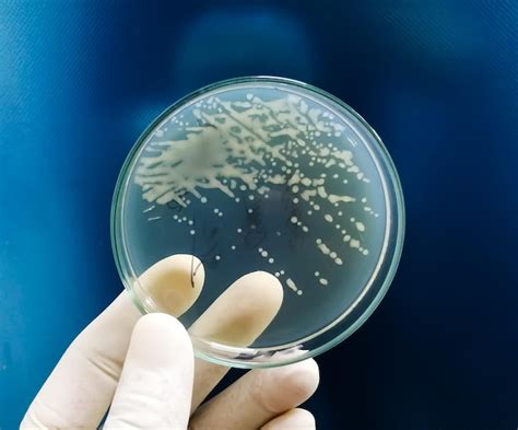 Gram negative bacteria growth on uti agar media | Premium Photo
