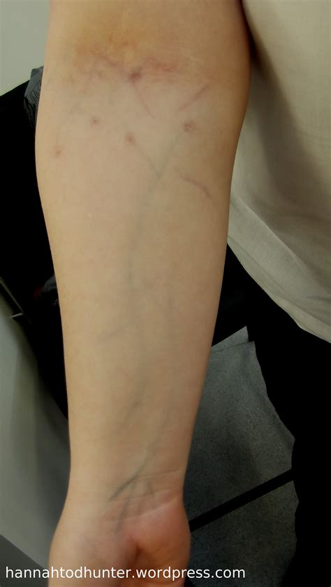 Define Track Marks at Marilyn Stumpf blog