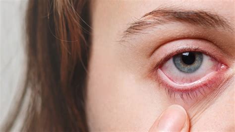 साल 2023 में इन बीमारियों ने किया लोगों को परेशान, जरूरी है सावधानी ...