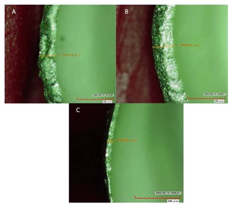Marginal Misfit of 3D-Printed (Selective Laser Sintered), CAD-CAM and ...