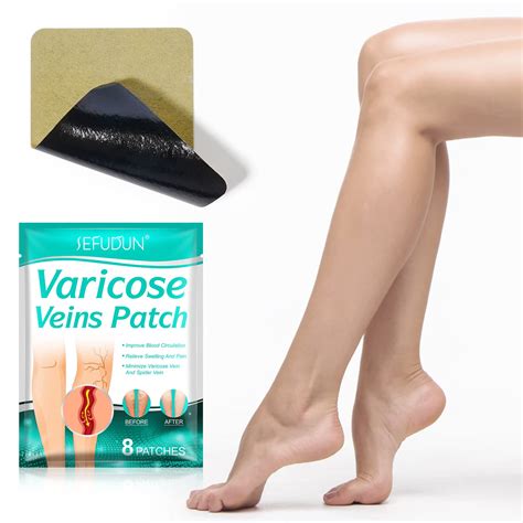 Varicose Veins Treatment For Legs Varicose Veins Patch Relief Leg ...
