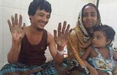 Bangladesh Tree Man undergoes 16 surgeries for Epidermodysplasia ...