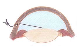 Medpulse - Volume 11 Issue 1