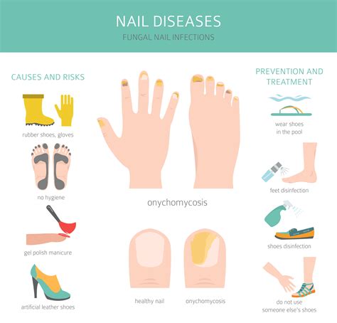 Green Nails Disease at Rita Clark blog