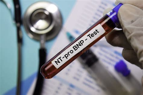 Image result for Quest BNP Process Lab