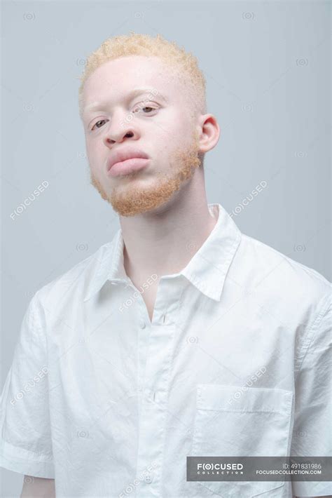 Pretty Albino Person