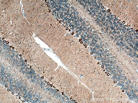 Alpha Synuclein antibody (66412-1-Ig) | Proteintech