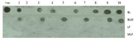 Antiviral Action of Native and Methylated Lactoferrin and β ...