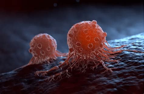 Image result for How Skin Cancer Forms