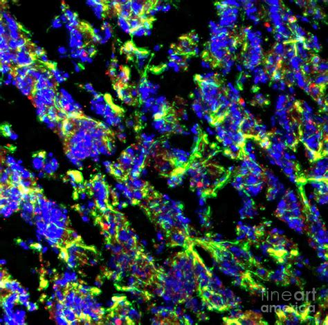 Image result for Astrocyte