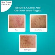 Buy Salicylic & Glycolic Acid Anti-Acne Serum Online