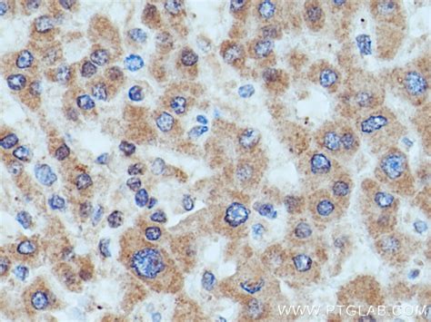HMGCR antibody (13533-1-AP) | Proteintech
