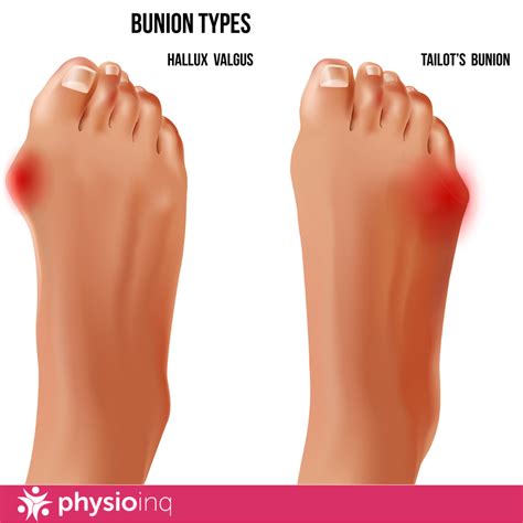 Running Feet 的图像结果