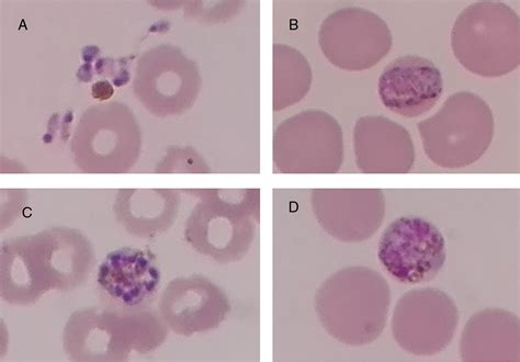 SciELO Brasil - Malaria, the role of the blood smear - a case report ...