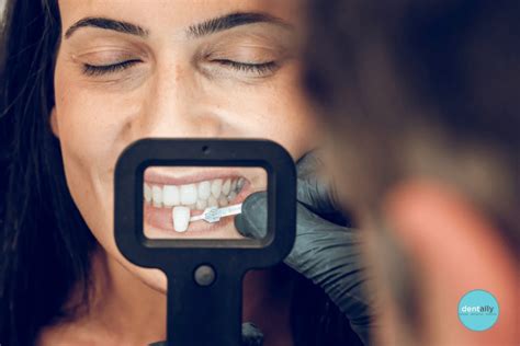 What is the Cost of Veneers for Two Front Teeth in India?