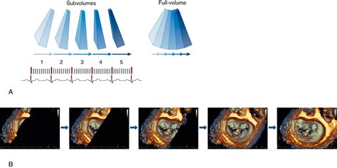 Perioperative Echocardiography - Clinical Tree