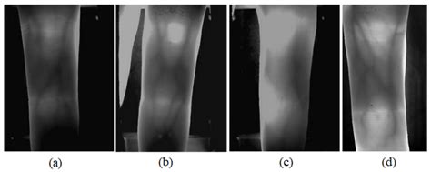 A Novel ROI Extraction Method Based on the Characteristics of the ...