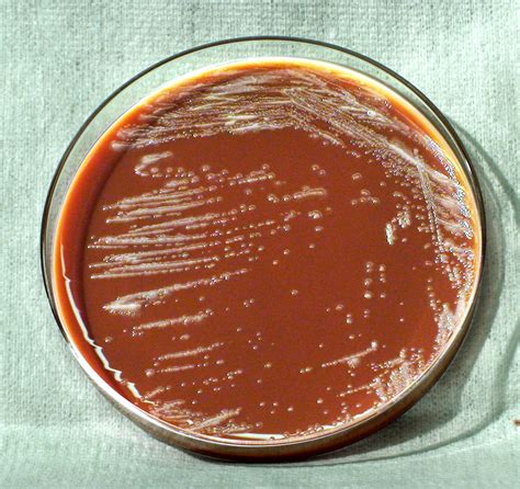 Free picture: morphology, gram, negative, yersinia pestis