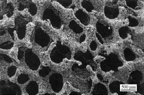 New Developments of Ti-Based Alloys for Biomedical Applications