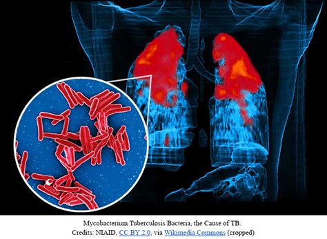 TB bacteria's Tough Armor: A Cellular Shield Against Treatment | IITBombay