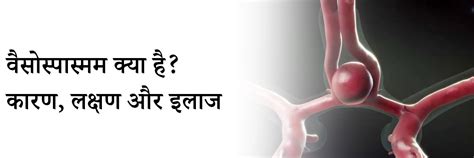 वैसोस्पास्मम क्या है? कारण, लक्षण और इलाज | What is Vasospasm in Hindi