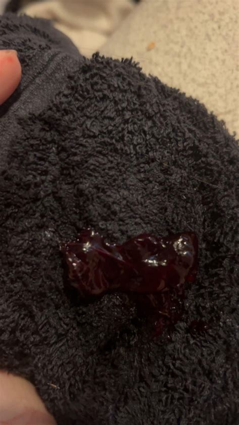 blood clots GRAPHIC PICS !! : r/Periods