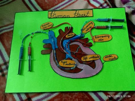 Heart Structure Tutorial 的图像结果