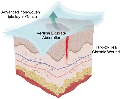 Technical Evaluation of a New Medical Device Based on Rigenase in the ...