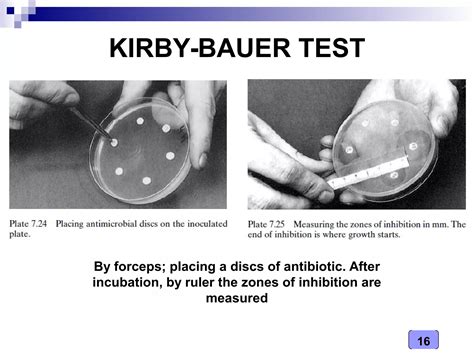 Medical Microbiology Laboratory (Antibiotics Sensitivity Testing) | PDF