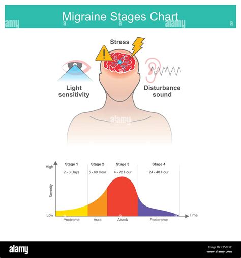 Migraines stages chart, Migraines stages chart and a factors cause of ...