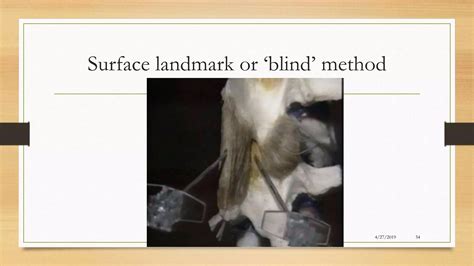 Injection Back Pain 的图像结果