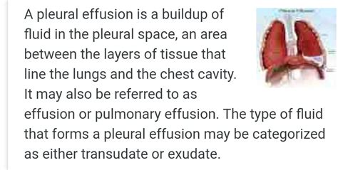 function of pleural fluid - Brainly.in
